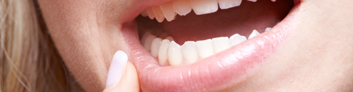 Oral Surgery Wisdom Teeth 48
